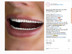 Pasang Gambar Menyeramkan, Iklan Pemutih Gigi Ini Heboh di Medsos