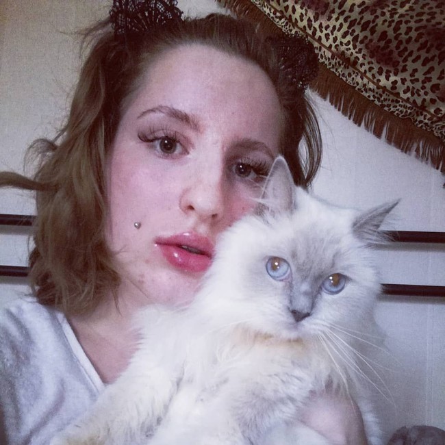 Bibir wanita asal Swedia ini menjadi lebih menonjol dan besar. Ia pun mengaku sangat menyukai penampilannya kini dan dipuji oleh para pengikutnya di Instagram.  Foto: Instagram