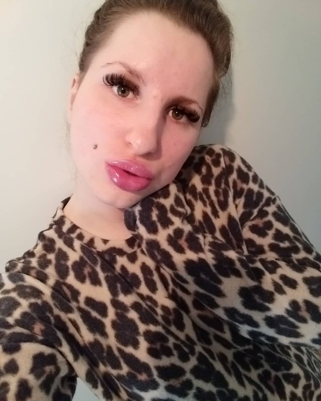 Bibirnya yang lebih bengkak ini membuat dirinya selalu menjadi pusat perhatian. Tak banyak orang yang menyebut penampilan bibirnya itu terinspirasi dari Kylie Jenner. Foto: Instagram