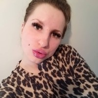 Bibirnya yang lebih bengkak ini membuat dirinya selalu menjadi pusat perhatian. Tak banyak orang yang menyebut penampilan bibirnya itu terinspirasi dari Kylie Jenner. Foto: Instagram