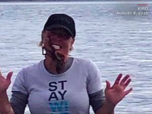 Iseng Taruh Gurita Beracun di Wajah, Wanita Ini Dilarikan ke RS