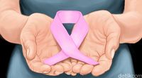 Obat penyakit kanker payudara ditemukan oleh siswa SMA.