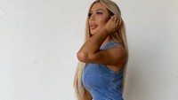 Bintang MTV itu juga kecanduan dengan operasi plastik hingga membuat wajahnya berubah. Dok. Instagram/chloegshore1