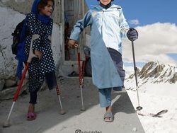 Perbandingan Dua Foto Kehidupan yang Menyayat Hati