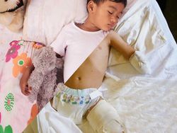 Perbandingan Dua Foto Kehidupan yang Menyayat Hati