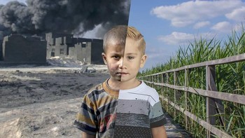 Dan semoga negara-negara yang masih berkonflik segera damai, sehingga tidak ada lagi anak-anak yang menjadi korban perang. Foto: Uğur Gallenkuş