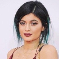 Di bulan-bulan berikutnya tampak semakin jelas perubahan bibir adik dari Kendall Jenner itu.  Foto: Instagram