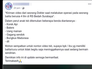 Viral Video Operasi Perut Balita Berisi Korek Api di Surabaya, Bagaimana Faktanya?