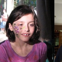 Sedikit perbaikan pada gigi ternyata membuat remaja 18 tahun ini menjadi sangat cantik. Foto: istimewa/The Brightside/Reddit