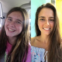 Pengguna Reddit dengan nama akun curriespice mengunggah foto sebelum dan sesudah dia memutihkan giginya. Ini perbedaannya saat ia berusia 12 tahun dan 23 tahun.Foto: istimewa/The Brightside/Reddit