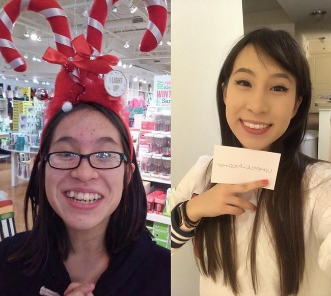 Akun bernama moose_pudding di Reddit membagikan transformasinya saat usia 14 tahun dan 19 tahun. Dia mengaku melakukan banyak perubahan pada dirinya, termasuk merapikan gigi. Foto: istimewa/The Brightside/Reddit