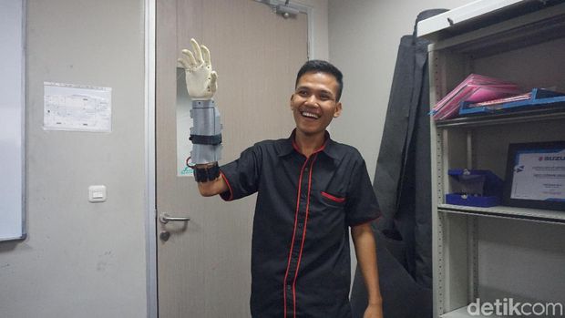 Rian beruntung bisa memakai lengan bionik ini.