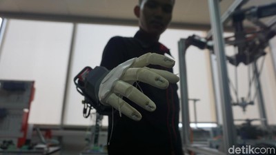 Foto: Penampakan Tangan Bionik Asli Tangerang yang Beneran Mirip Iron Man