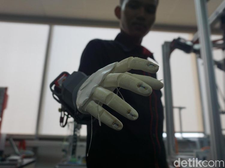 Foto: Penampakan Tangan Bionik Asli Tangerang yang Beneran Mirip Iron Man