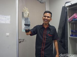 Ini Pemakai Tangan Bionik Asli Tangerang, Lengan Aslinya Tergiling Mesin Pon
