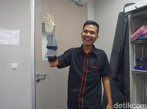 Ini Pemakai Tangan Bionik Asli Tangerang, Lengan Aslinya Tergiling Mesin Pon