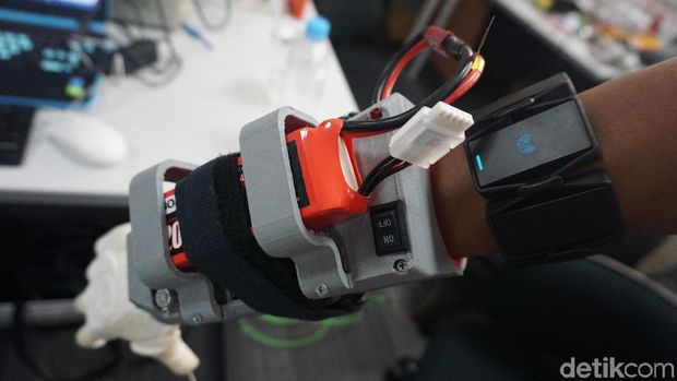 Lengan bionik ini bekerja dengan sensor canggih.