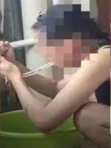 Miris, Gadis-gadis di China Muntah Pakai Selang Demi Punya Tubuh Langsing