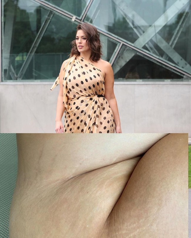 Baru-baru ini Ashley Graham jadi viral setelah memamerkan stretch mark di Instagramnya.  Tampak stretch mark di area paha dan pinggang model dan aktris yang tengah hamil ini. Same same but a little different, tulis perempuan 31 tahun itu. Foto: Instagram