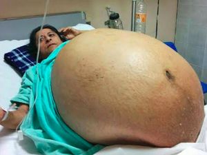 Foto Wanita Ini Viral, Benarkah Sedang Hamil 11 Anak Sekaligus?