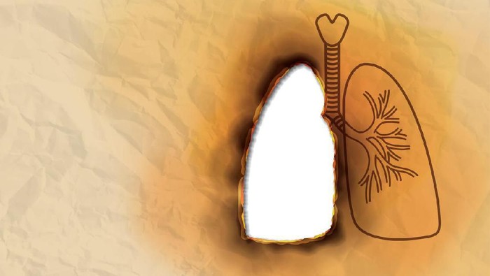 Doctor shows results to old patient x-ray of the lungs, smoking cigarettes problem