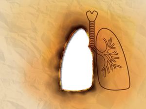 Deretan Penyumbang Tekornya BPJS Kesehatan, Penyakit Terkait Rokok Mendominasi