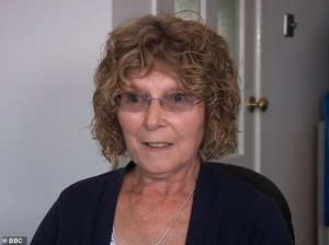 Cari Dokter Suntik Botox di Facebook, Wajah Wanita Ini Jadi Mirip Alien