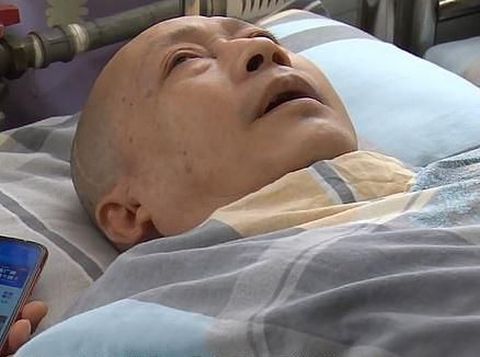 Kisah Haru Perjuangan Istri Rawat Suami yang Koma Selama 5 Tahun