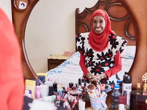 Kisah Inspiratif Farah, Hijabers dengan Wajah Rusak Akibat Scleroderma