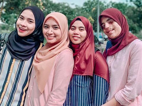 Mahasiswi yang Separuh Wajahnya Rusak Ini Viral, Tampil PD Foto #OOTD