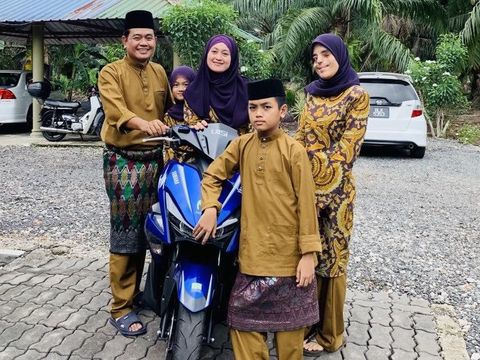 Mahasiswi yang Separuh Wajahnya Rusak Ini Viral, Tampil PD Foto #OOTD