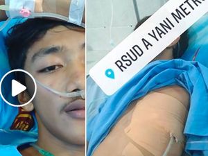 Viral Kisah Niko, Eks Perokok yang Nyaris Kehilangan Satu Paru-paru