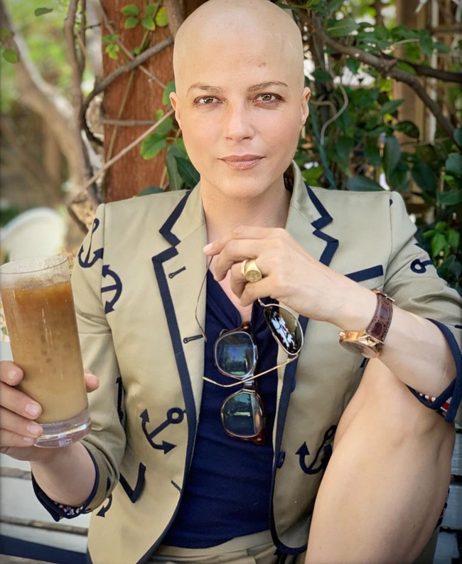 Karena penyakitnya tersebut, Selma mengaku di beberapa bagian tubuhnya masih bengkak dan persendiannya terasa sakit. Matanya pun masih tidak fokus. Namun, aktris 47 tahun itu mengaku sudah bisa berjalan lebih baik.  Foto: Instagram