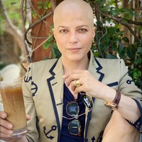 Karena penyakitnya tersebut, Selma mengaku di beberapa bagian tubuhnya masih bengkak dan persendiannya terasa sakit. Matanya pun masih tidak fokus. Namun, aktris 47 tahun itu mengaku sudah bisa berjalan lebih baik.  Foto: Instagram