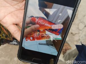 21 Bocah Keracunan Permen Pasta Gigi, Bupati Bandung: Waspada!