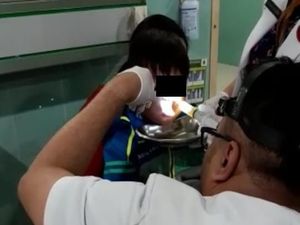 Kisah Viral Lintah di Hidung Bocah Solo, Berawal dari Renang