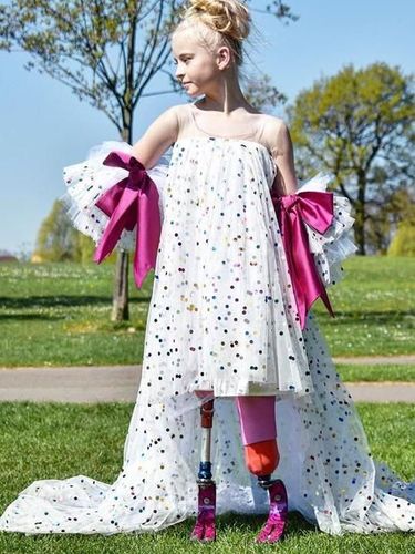 Model Cilik yang 2 Kakinya Diamputasi Akan Tampil di New York Fashion Week