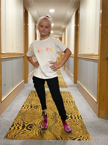 Model Cilik yang 2 Kakinya Diamputasi Akan Tampil di New York Fashion Week