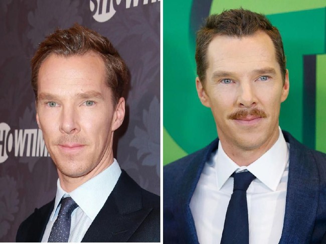 Mata Benedict Cumberbatch mengalami kondisi yang dinamakan heterochromia sektoral. Warna iris matanya merupakan percampuran antara biru dan hijau. Kondisi ini menyebabkan mata pemeran Doctor Strange ini terkadang berwarna hijau, kadang berubah biru, tergantung pencahayaan. Foto: John Lamparski/Getty Images