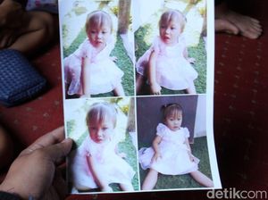 Bukan Hanya Mata, Rambut Bocah Amel Bisa Berubah Warna