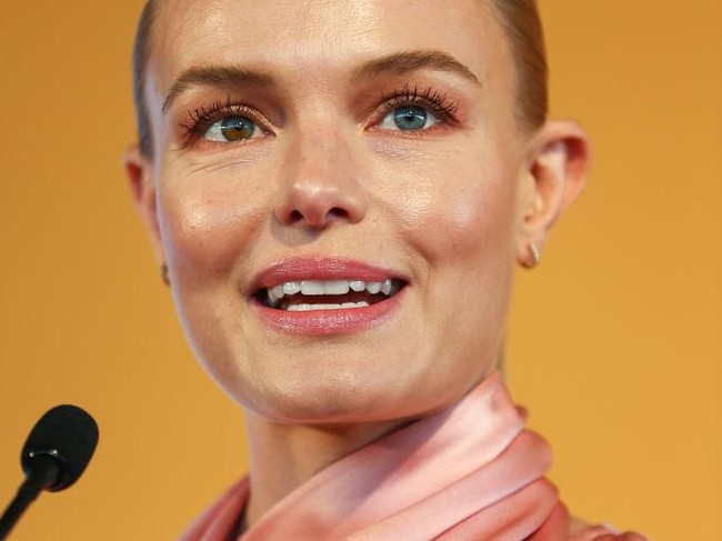Kate Bosworth mengalami kondisi yang dinamakan heterochromia, yakni ketika iris mata berbeda warna karena distribusi melanin (pigmen) yang tidak seragam. Aktris asal Los Angeles ini diketahui memiliki warna biru pada mata kiri, dan hazel bercampur biru di mata kanan. Foto: Brendon Thorne/Getty Images