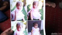 Sambil memangku Amel, Reni menunjukkan foto putrinya itu saat warna bola mata berubah menjadi biru. Sepintas mata Amel seperti menggunakan softlens. Kendati warna mata Amel kerap berubah, Reni menyebut, tidak ada perubahan prilaku yang terjadi pada buah hatinya itu.