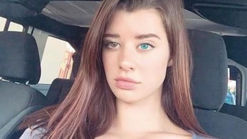 Mataku ini membuatku jadi pusat perhatian, katanya dalam sebuah wawancara. Foto: Instagram