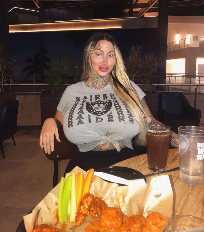 Seperti dilansir Metro, wanita asal Toronto, Kanada ini menjalani operasi plastik sejak ia berusia 14 tahun dan merasa kecanduan. Mary pun mengaku tidak pernah membayangkan akan mendapatkan banyak operasi plastik. Foto: Instagram