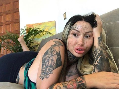 Obsesi dengan Oplas, Wanita Ini Kini Ingin Punya Area Intim 'Tergemuk'