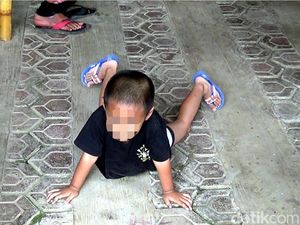 Harapan Ortu di Cianjur yang Anaknya Berkelamin Ganda