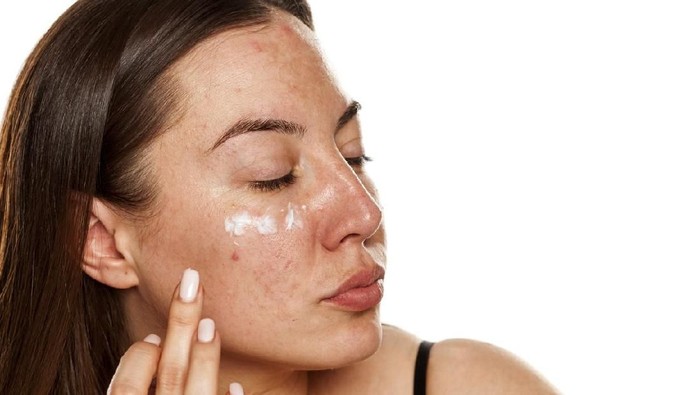 Hiperpigmentasi: Tipe, Gejala, Penyebab, dan Tips Mencegahnya