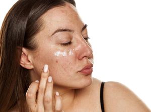 Pakai Krim Kulit Mengandung Merkuri, Wanita Ini Jatuh Koma