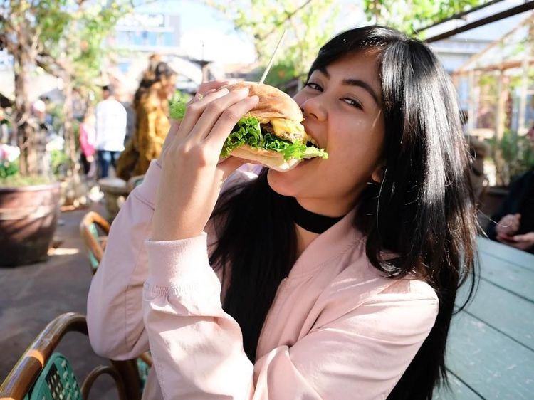 Cantiknya Istri Bima Aryo, Dokter Gigi yang Suka Makanan Manis