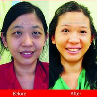 Wajah Anti Flek Hitam? Yuk Kenalin 'Diamond Bright Intensive Serum'